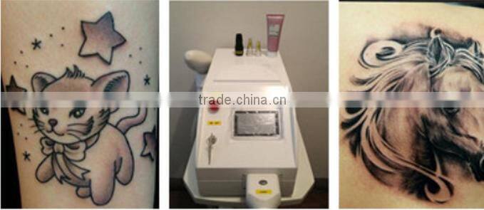 SQ-3 Q Best selling products portable nd yag remove tattoo laser/ erbium yag laser/ erbium yag