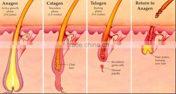 High quality E11C - Erica Q- switch nd yag laser tattoo removal ipl shr laser hair removal