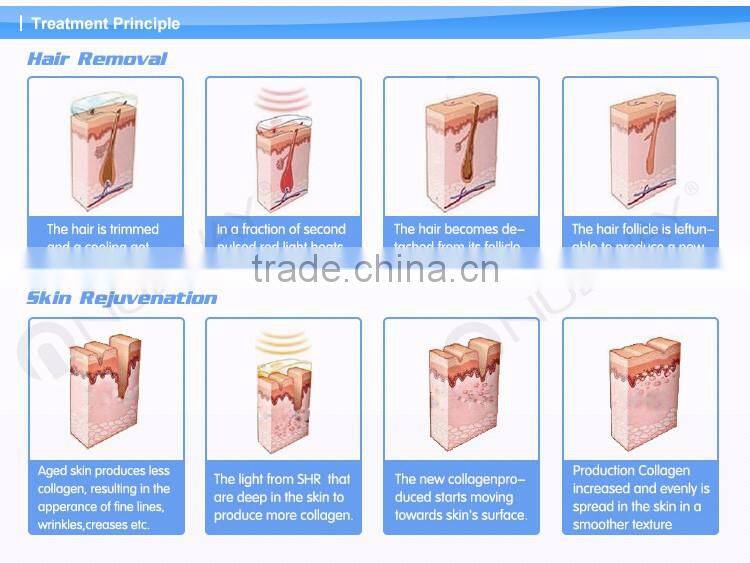 Amazing price ipl shr laser pig hair removal machine for skin rejuvenation