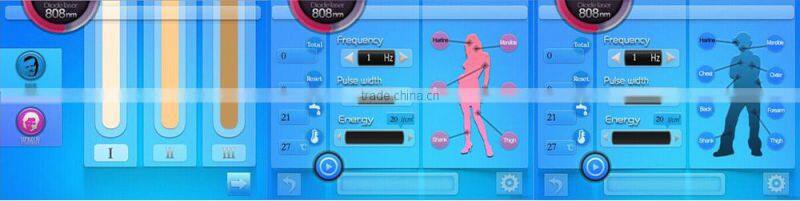 Portable 808nm diode laser hair removal machine for unhairing