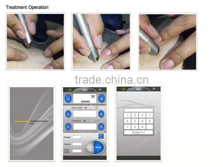 OD-H980 Portable 980nm laser spider vein removal