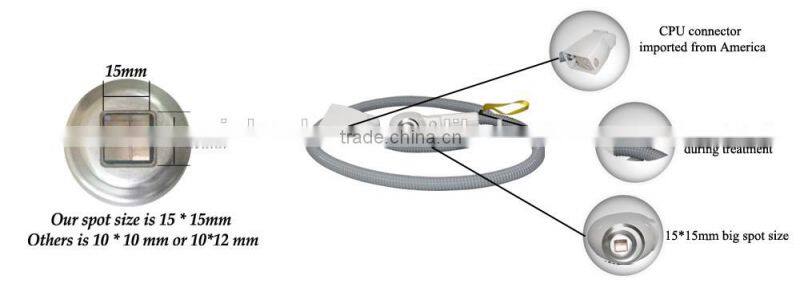 808nm laser hair removal / laser diode / 808 diode laser