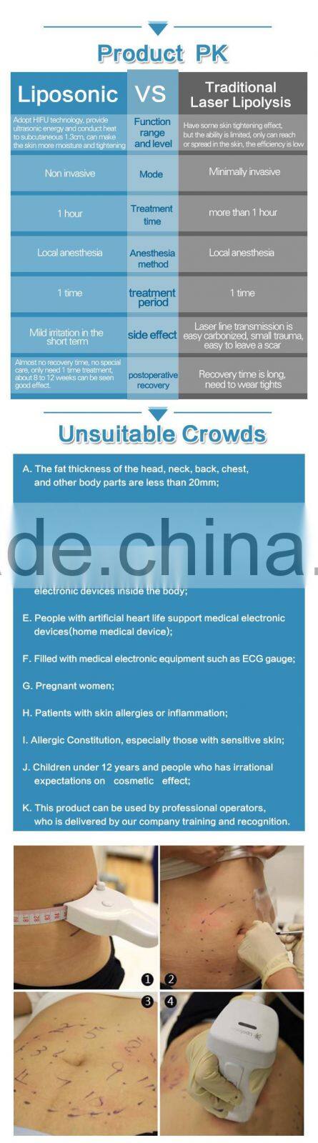 2016 Hot weight loss slimming HIFU machine