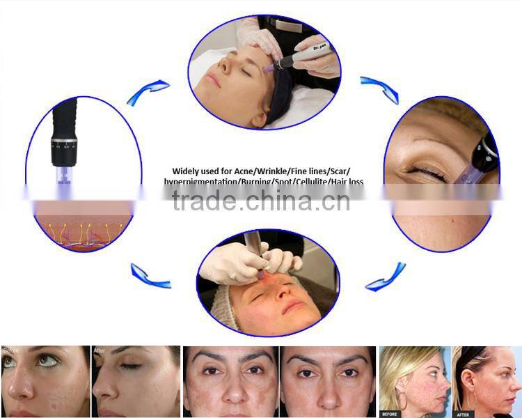 Hot sale personal Derma pen M7 Electric Micro Needle pen 2 batteries Rechargeable dermapen