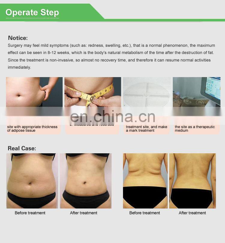 Renlang vertical liposonic slimming machine for body/Waist weight lost with 8mm and 13mm head