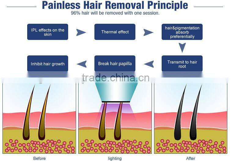 portable ipl hair removal machine