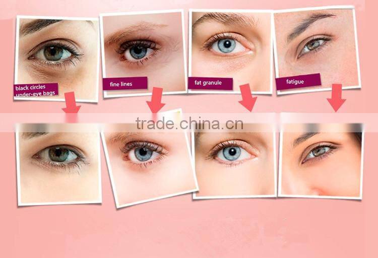 Ion Face Lift Massager,Eye Wrinkle Removal Massager, Anti Aging Skin Care Treatment