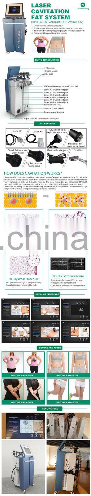 2021 new new 2022 80k cavitation machine body rf cavitation slimming machine massage lipo slim machine lipocavitation body shaping