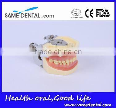 Dental Moderate Periodontal Disease Model Teaching Demonstration