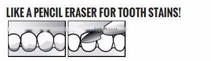 Hot sell pretreatment liquid natural teeth whitening stain remover