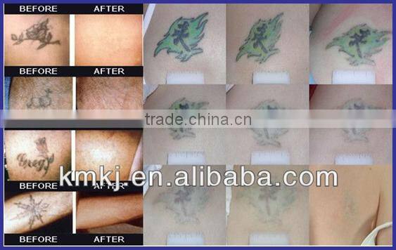 4 in 1 Big power spa use multifunction elight rf nd yag laser machine with IPL