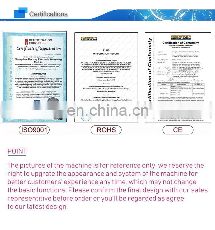 Hot selling q-switched nd yag laser  tattoo removal RF  DPL hair removal for women