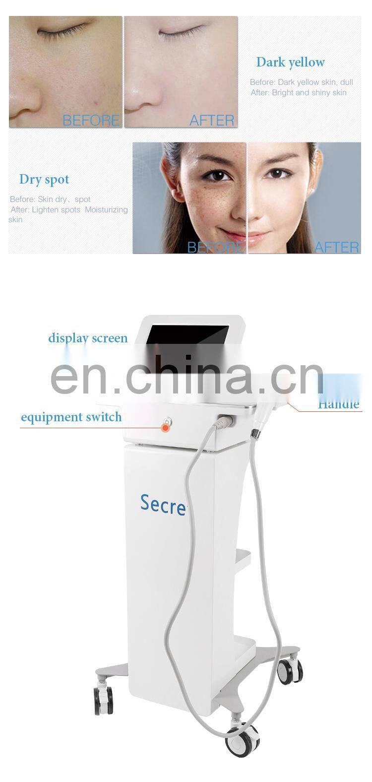 Portable microneedle skin rejuvenation machine/fractional rf micro needle for face and body