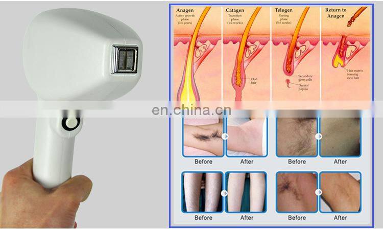 dj laser lights for sale 808nm diode laser hair removal machineand mini laser cutting machine in Guangzhou Renlang