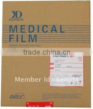 kodak film wholesale,x-ray mobile,tone tube