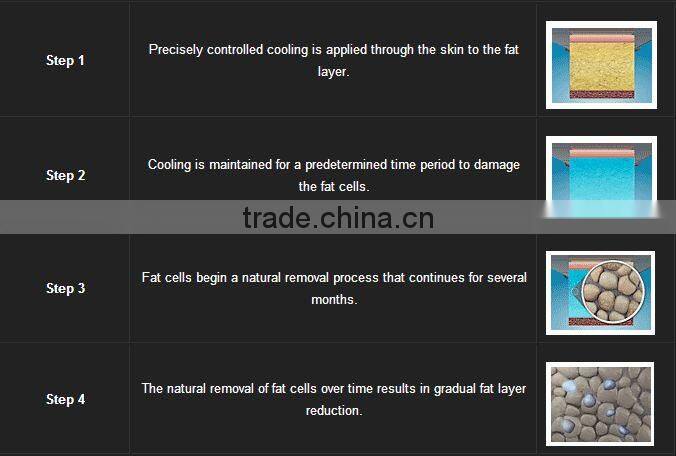 fat freezing machine/venus freeze machine