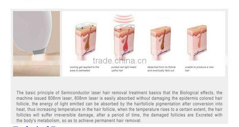 2016 high power effective laser 808nm hair removal machine laser removal