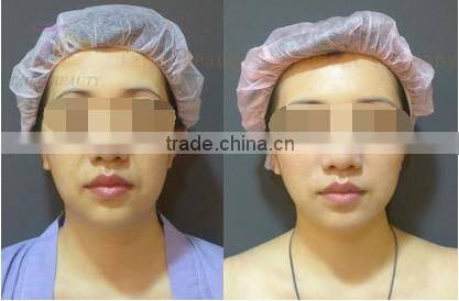 professional water oxygen skin tightening beauty salon equipment