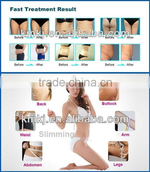 CE ISO cavitation rf 3 in 1 slimming beautifying machine with vacuum