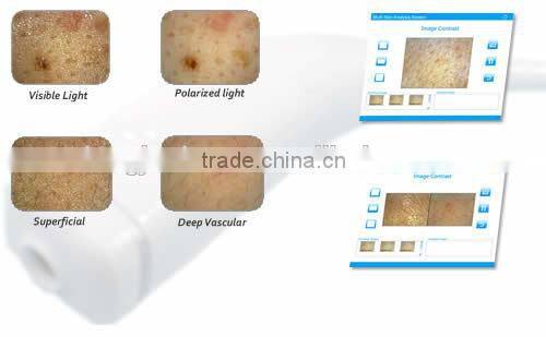 Professional skin analyzer portable skin analyzer with CE