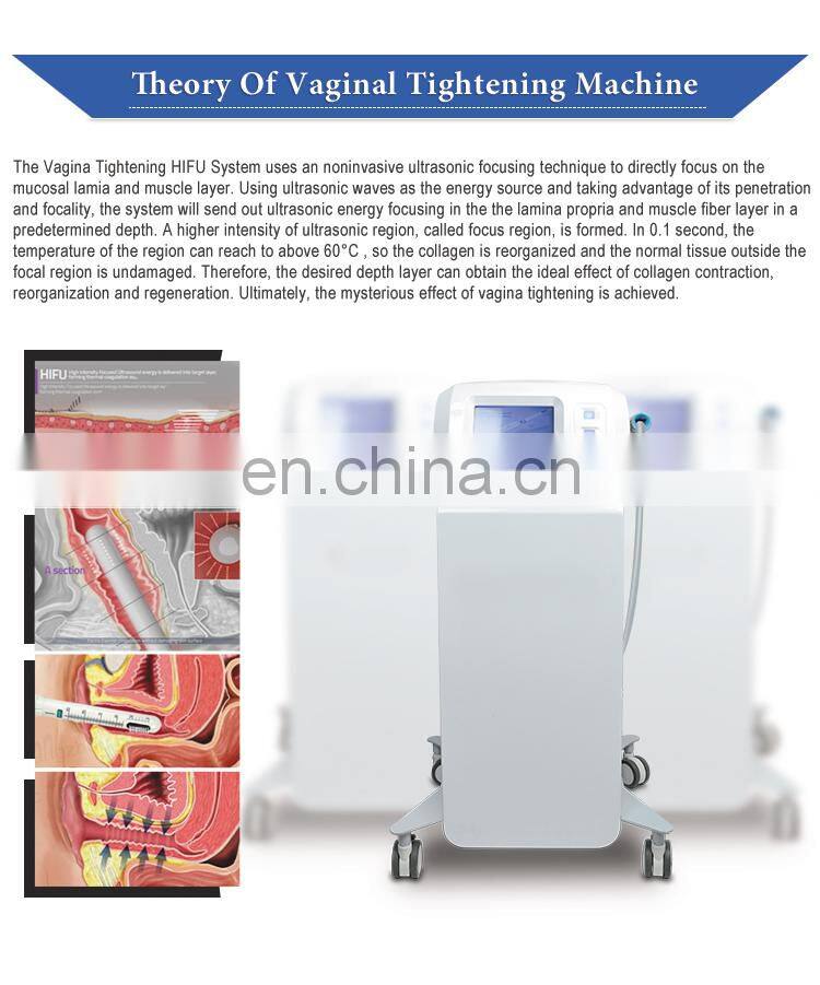 360-degree vaginal tightening Hifu skin rejuvenation treatment machine