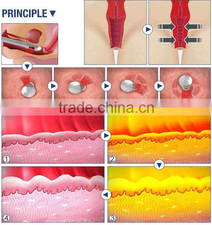 co2 fractional laser wart removal scar removal beauty cutting machine