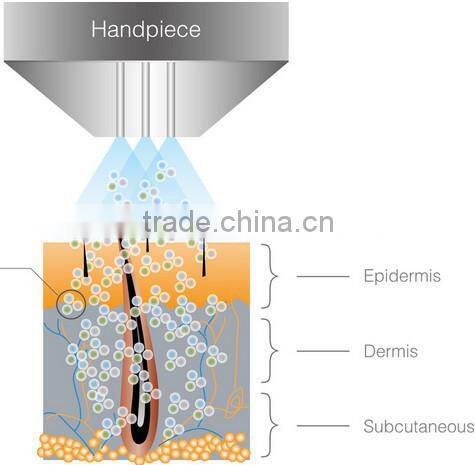 Effective spa product NL-HS202 /diamond dermabrasion/ water dermabrasion machine