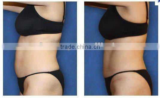 slimming machine reduce cellulite hot sale -F017