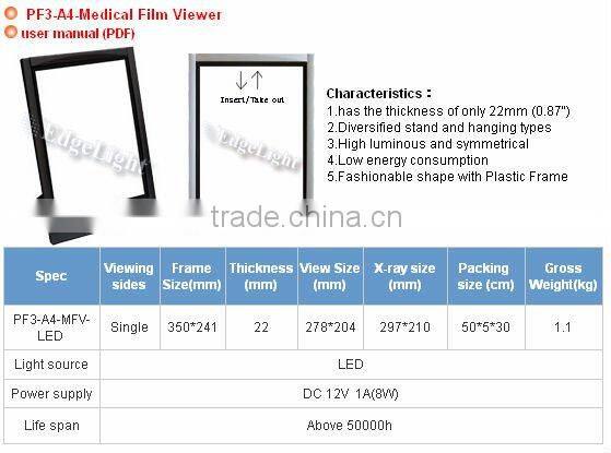 Medical negatoscope film viewer