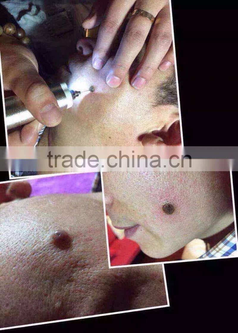 2015 New Wholesale Professional mini Tatoo Spot Mole Laser Remover freck spot removal laser pen