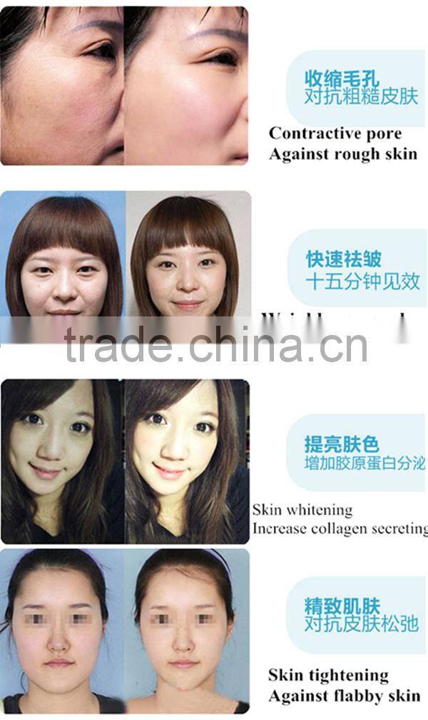 Portable no needle mesotherapy electroporation machine BD-L033