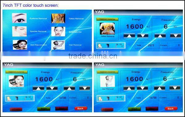 2015 Newest Tattoo Laser Removal Machine Q-Switch ND:YAG Device