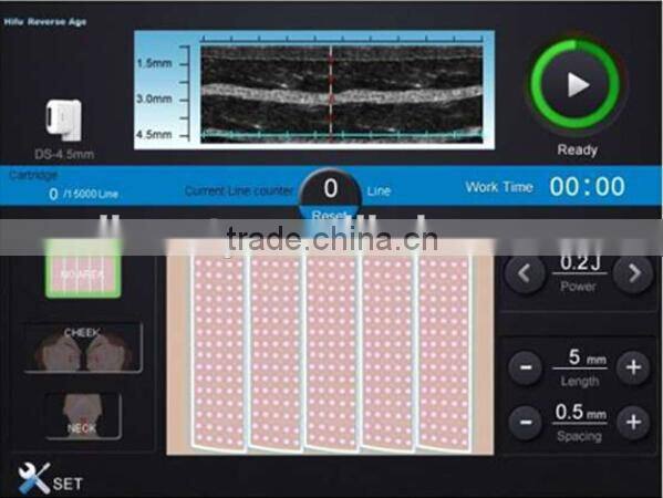 HIFU Ultrasound Vacuum Body Shaping Machine For Weight Loss