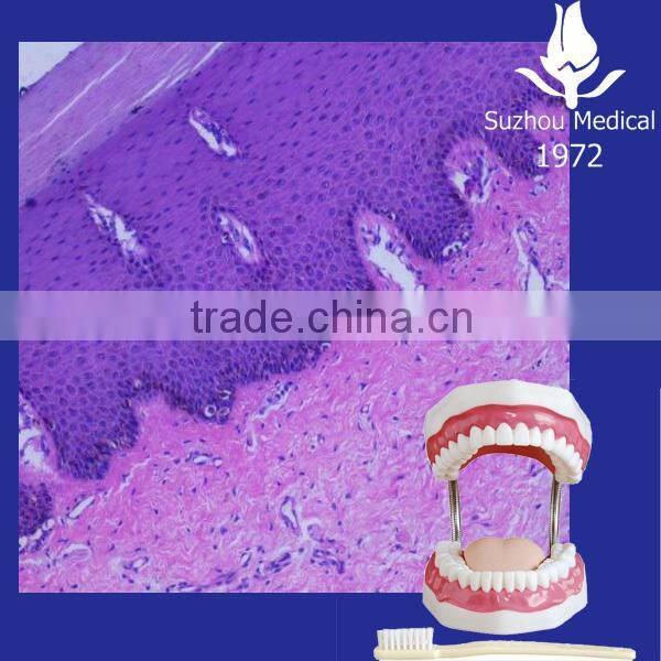 Oral pathological slides