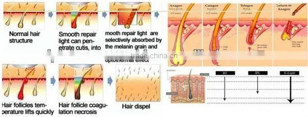 Biggest Promotion of 50% Discount in August !!! Newest and High Quality 3 handles ipl replacement lamp
