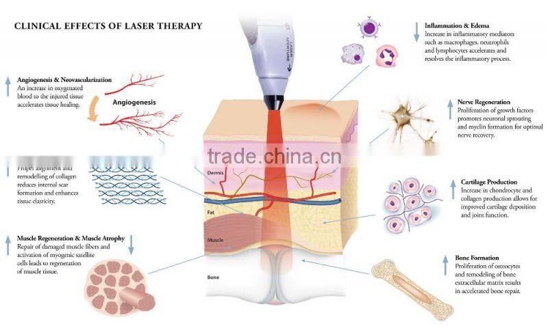 Diode laser for pain relief machine/Shock wave laser equipment