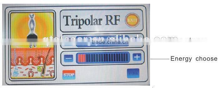 good news!!! 2015 renewed weight loss laser device/slimming equipments cellulite reduction apparatus
