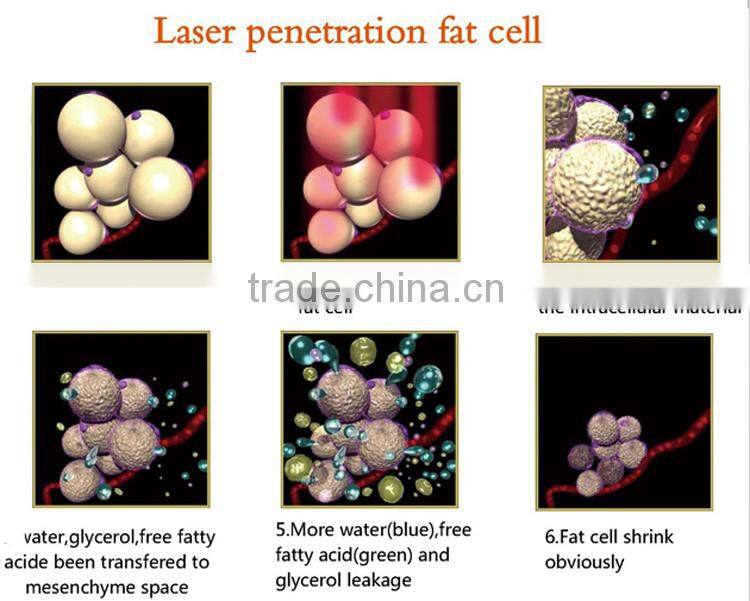 OEM ODM high quality 2 in 1 lipo ultrasonic cavitation device for weith loss