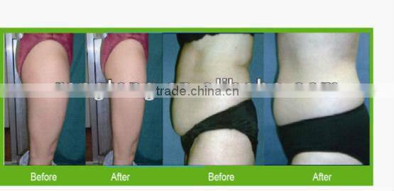 new rf slimming burn fat machine face lifting improve strech marks med-360