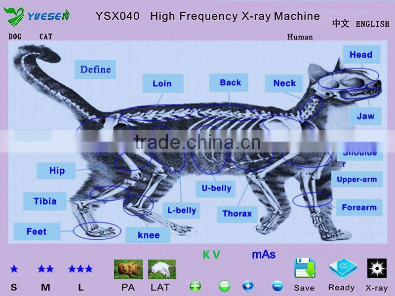 Hospital medical radiography equipment portable xray