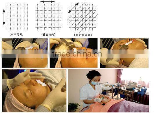 540 derma roller cheap price selling