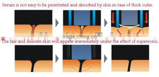 2015 home beauty device skin scrubber microdermabrasion