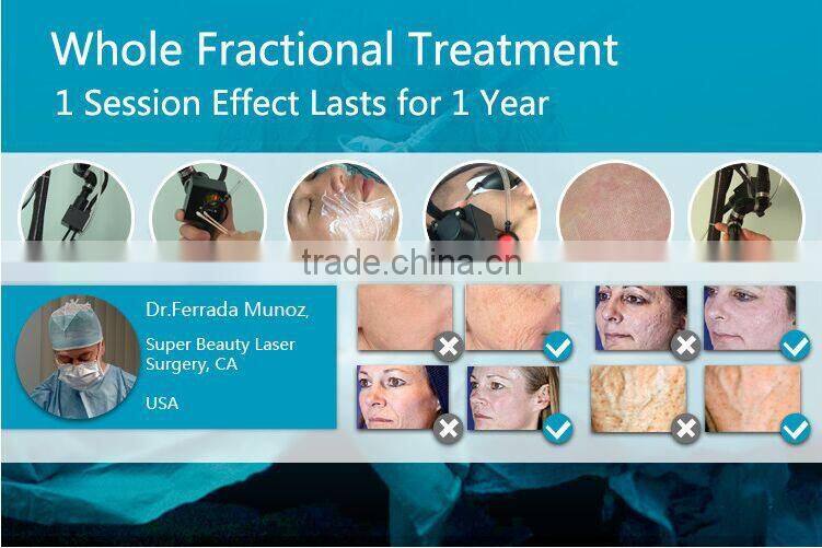 2015 CO2 Fractional Laser with 3 Shot