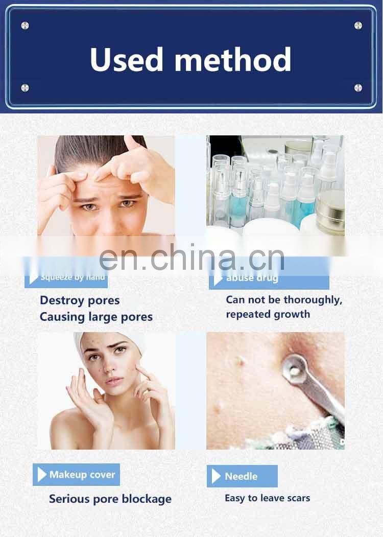 Hot selling best acne treatment acne scar removal blackhead removal beauty device