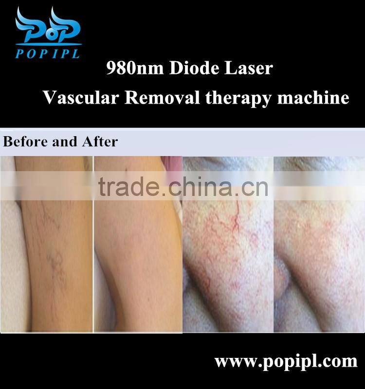 980nm diode laser Vascular Leg Vein treatment machine POPIPL