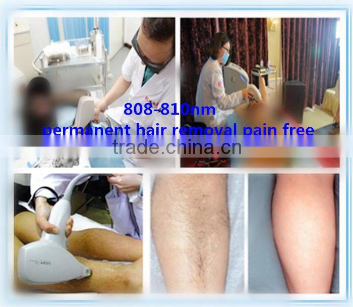 depiladora laser diode 808 for permanent hair removal