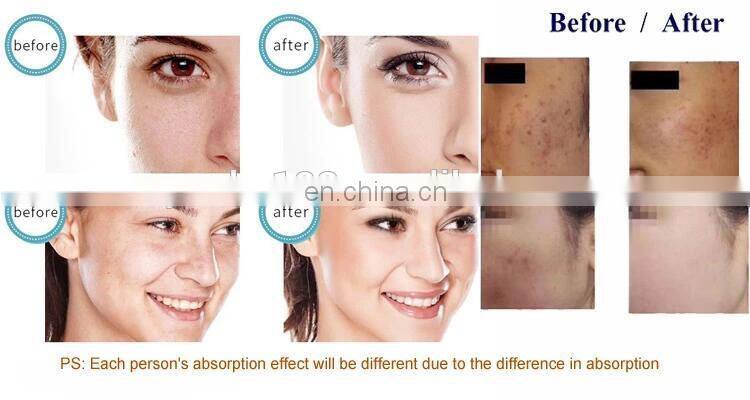 Newest UltraSound Machine No Needle Mesotherapy Aqua Injector Wrinkle Removal Facial Skin Moisturizing Machine