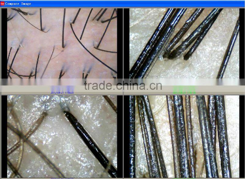 new products looking for distributor magic mirror skin scanner analyzer 5.0 MP High Resolution CCD USB skin scope