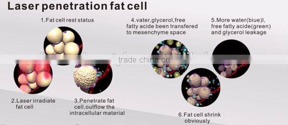 High tech weight loss lipo laser body slimming, cellulite reduction lipo laser machine LP01