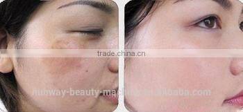 1800W Big Power 3 Functions Skin Tightening Blood Vessel Remove Laser Medical Beauty Equipment IPL Lamp